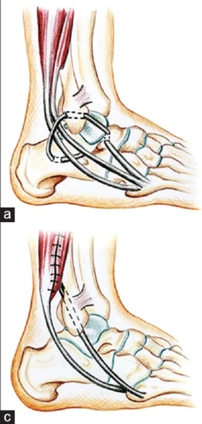 Crédits: Al-Mohrej et al.