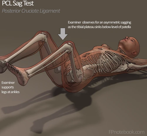 https://fpnotebook.com/ortho/exam/PclSgTst.htm