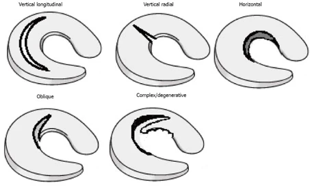 Crédits: Mordecai et al 2014