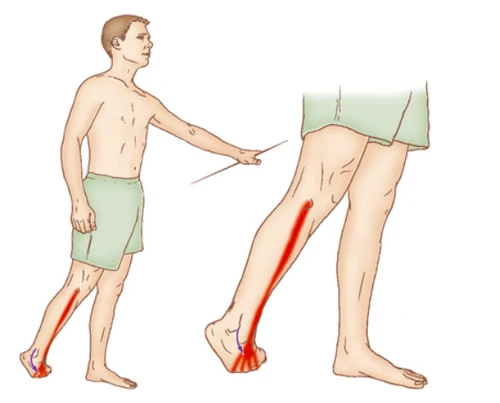 Source: https://clemedicine.com/19-region-n-10-palpation-des-muscles-de-la-jambe/